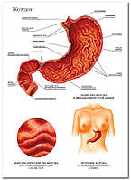 Желудок - плакат