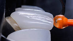 Адгезивні сис-ми:травильні гелі, бонди, праймери