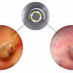 Отоскоп LuxaScope Auris CCT LED 2.5В, чорний, Luxamed, фото 3