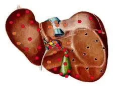 4505629553 w640 h2048 diagnostika 3