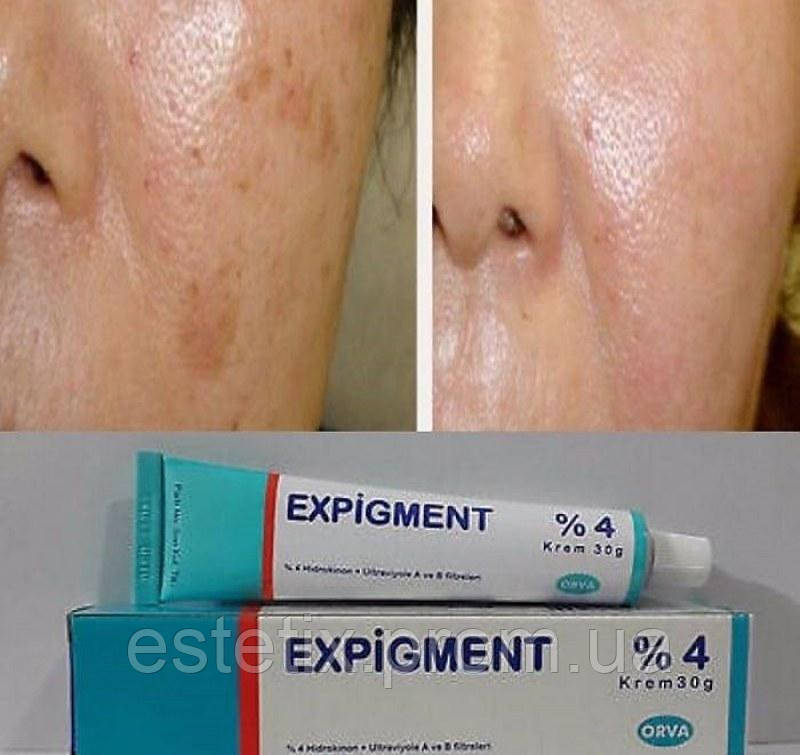 Expigment 4 Купить В Москве