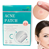 Патчи от прыщей и акне 72 шт Acne Patch / Невидимые противовоспалительные наклейки / Пластырь для лечения акне