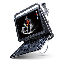 Ультразвуковой сканер Ebit 60 мобильный аппарат для ежедневных диагностических исследований