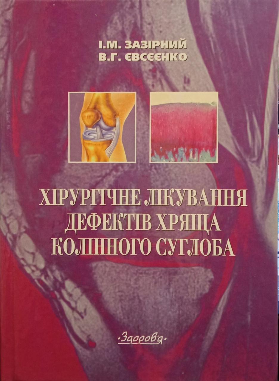 І.М. Зазірний, В.Г. Євсєєнко "Хірургічне лікування дефектів хряща колінного суглоба"
