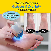 Аккумуляторная пемза для пяток Remove Calluses, Ch1, Хорошего качества, машинка для удаления мозолей, пилки