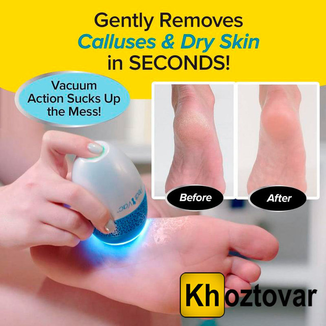 Аккумуляторная пемза для пяток Remove Calluses | Машинка для удаления мозолей - фото 3 - id-p1852902385