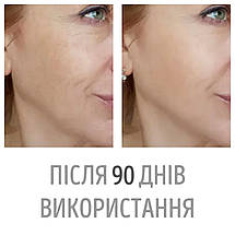 Масажер мікрострумовий для підборіддя Swan DS-FM0005з пультом для другого підборіддя білий, фото 4