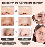 Апарат для глибокого вакуумного чищення пор обличчя Dermal Multi-Functional Cleaning, фото 8