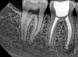 Комплект портативний дентальний рентген апарат VeRay + візіграф iTech для стоматології новинка 2023, фото 8