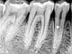 Комплект портативний дентальний рентген апарат VeRay + візіграф iTech для стоматології новинка 2023, фото 10
