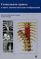 Спинальная травма в свете диагностических изображений Кассар-Пулличино В.Н.