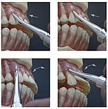 Набір люксаторов хірургічних (елеваторів, периотомов) Lussatore 6 шт., Medesy 730/SET, фото 2