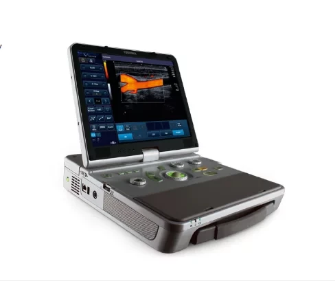Портативний УЗД апарат TOSHIBA (CANON) VIAMO (SSA-640A) (новий)