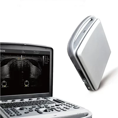 Портативний УЗД апарат CHISON SONOBOOK 6 (новий)