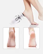 Електрична пемза Callus Remover Vacuum, фото 6