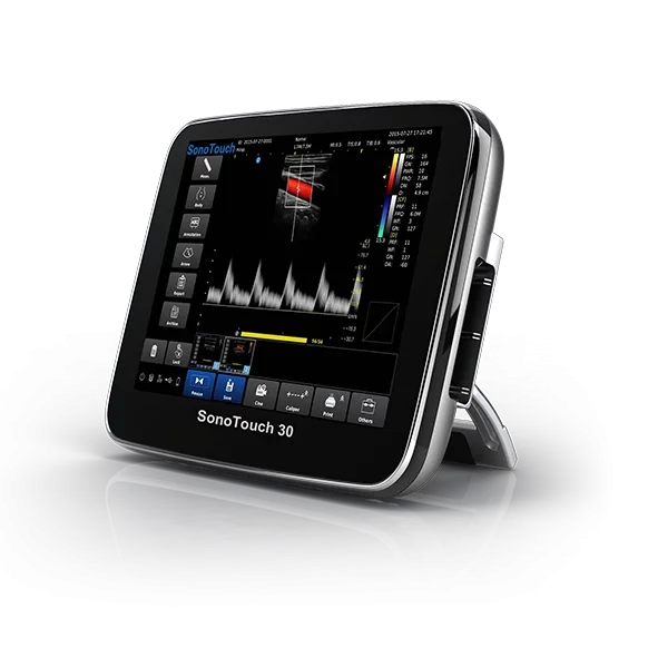 Портативний УЗД апарат CHISON SONOTOUCH 30