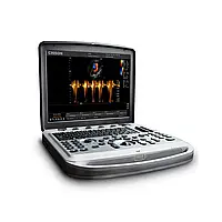 БУ с ЕС Портативный УЗИ аппарат CHISON SONOBOOK 8