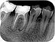 Портативний дентальний рентген апарат RESUN X Р3000 оригінал для стоматології рентгенівський дентальний 2023, фото 7