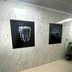 Монтаж стоматологической картины из двух модулей 1