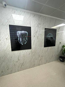 Монтаж стоматологической картины из двух модулей 2