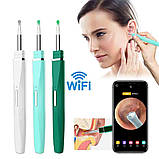 Інструмент для видалення вушної сірки Salorie з отоскопом 30X, фото 2