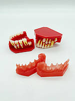 Стоматологічна Модель щелеп перехідний прикус в розрізі