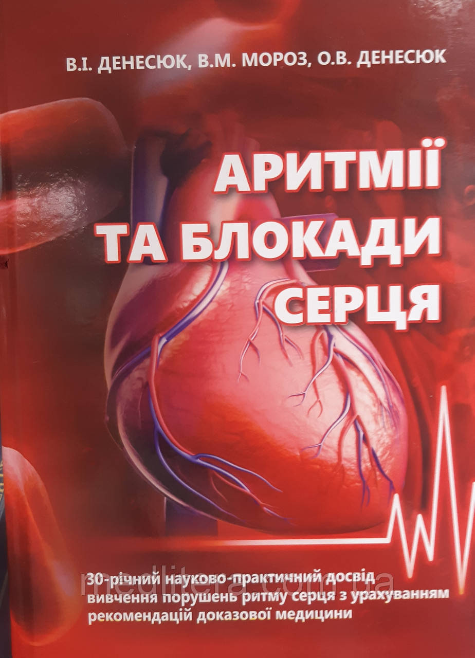 Денисюк В.И. Аритмії