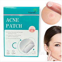 Пластырь от бородавок или прыщей пластырь от папилом и акне Acne Patch 72 шт.