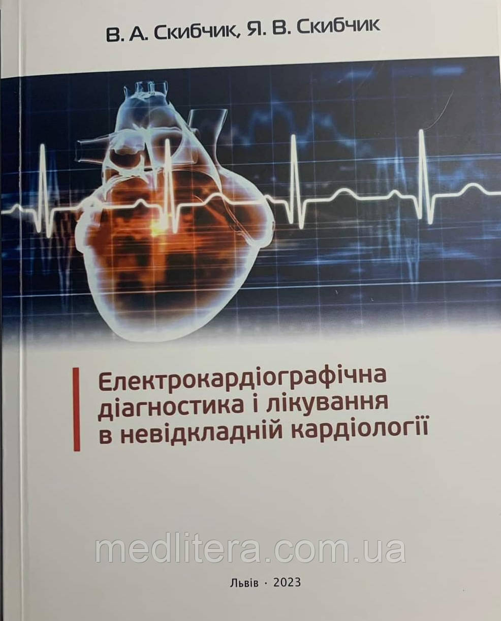 Електрокардіографічна діагностика і лікування в невідкладній кардіології. Видання 4-е. Скибчик В.А.,, фото 1