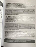 Електрокардіографічна діагностика і лікування в невідкладній кардіології. Видання 4-е. Скибчик В.А.,, фото 7