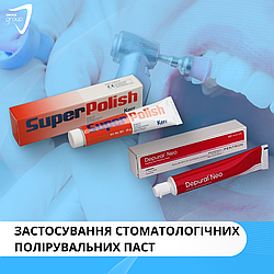 Застосування стоматологічних полірувальних паст