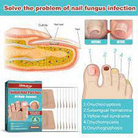 Пластирь для ремонта ногтей Fungal nail patches 16 шт