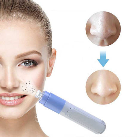 Вакуумний очищувач пор від вугрів Face spot, фото 2