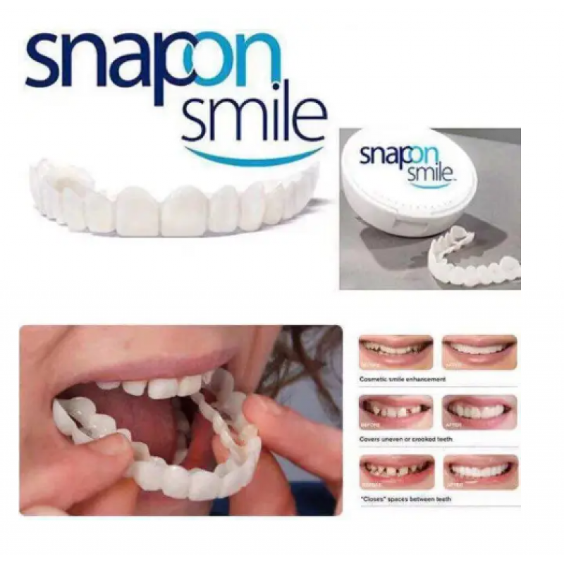 Вініри SnapOn Smile Veneers для зубів сніп він смайл 1 ЧЕЛЮ - фото 1 - id-p1875357223