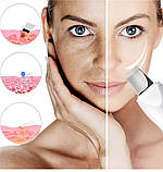 Портативний ультразвуковий скрабер для чищення обличчя MUYE 8815 апарат для очищення та зволоження шкіри, фото 7