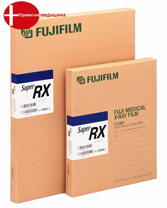 Рентгенплівка Fujifilm Super RX 35х35 (синьочутлива)