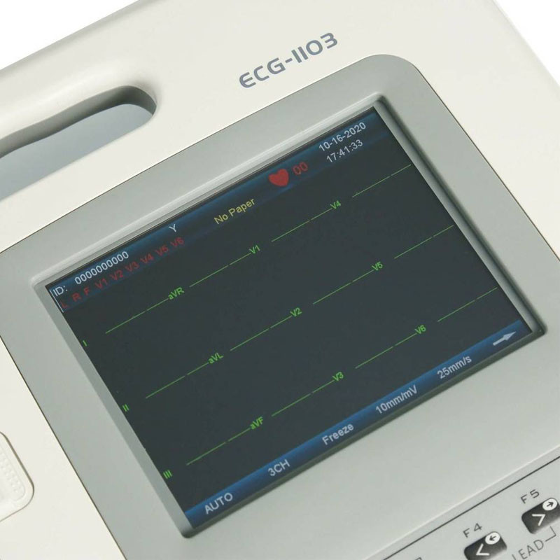 Электрокардиограф 3 канальный Carewell ECG 1103L портативный переносной аппарат ЭКГ с сенсорным экраном - фото 7 - id-p1880747630