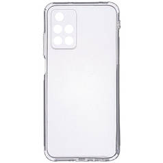 TPU чохол Epic Transparent 1,5mm Full Camera для Xiaomi Redmi 10