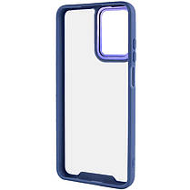 Чохол TPU+PC Lyon Case для Realme 10 4G, фото 5