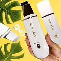 Ультразвукове чищення SKIN SCRUBBER (RD-1038), фото 1