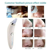 Derma Suction Вакуумный очиститель пор Аппарат для чистки лица от черных точек