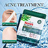 Тканинна маска для проблемної шкіри Sadoer  Acnes Oil Control Mask, 25 г, фото 4