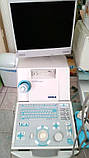 Апарат Ультразвукової Діагностики Ultrasonograf Honda HS-4000 USG 2 Head Videoprinter, фото 2