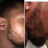 Олія для росту бороди Maxx Beard, фото 2