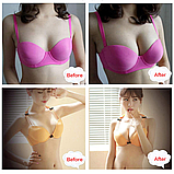 Силіконовий бюстгальтер / купальник, фото 3