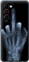 Чехол на Tecno Camon 18 Premier Рука через рентген "1007u-2652-18101"