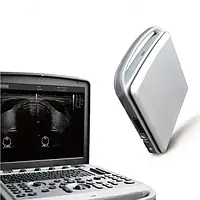 Портативный УЗИ аппарат CHISON SONOBOOK 6 (новый)