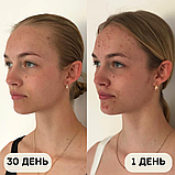 Спрей-очищувач для шкіри Сlinisoothe+ Skin Purifier 100 мл, фото 2