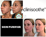 Спрей-очищувач для шкіри Сlinisoothe+ Skin Purifier 100 мл, фото 3