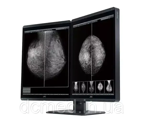 Медицинский монохромный монитор JVC MS-S500 5 MP Dualstand - фото 1 - id-p1896594174